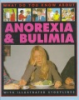 Anorexia___bulimia